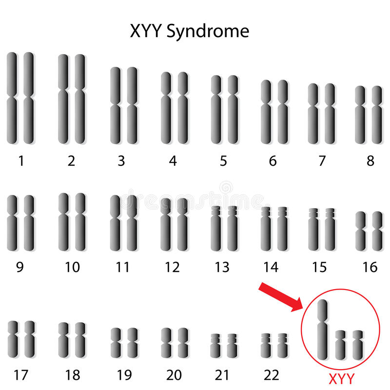 Sindrome XYY 1